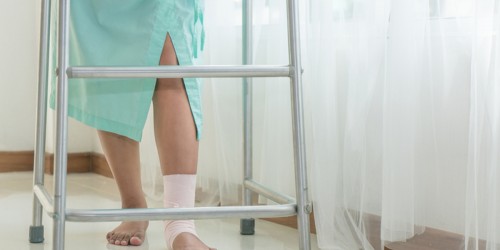 Does A History Of Broken Bones Increase Your Risk Of Being Diagnosed With Osteoporosis?