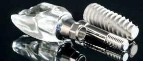 Нужна ли всем костная пластика во время операции по имплантации зубов?