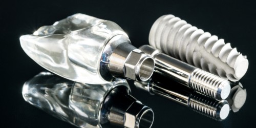 Does Everyone Need Bone Grafting During Dental Implant Surgery?