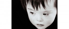 Down's syndrome: What Parents Need to Know