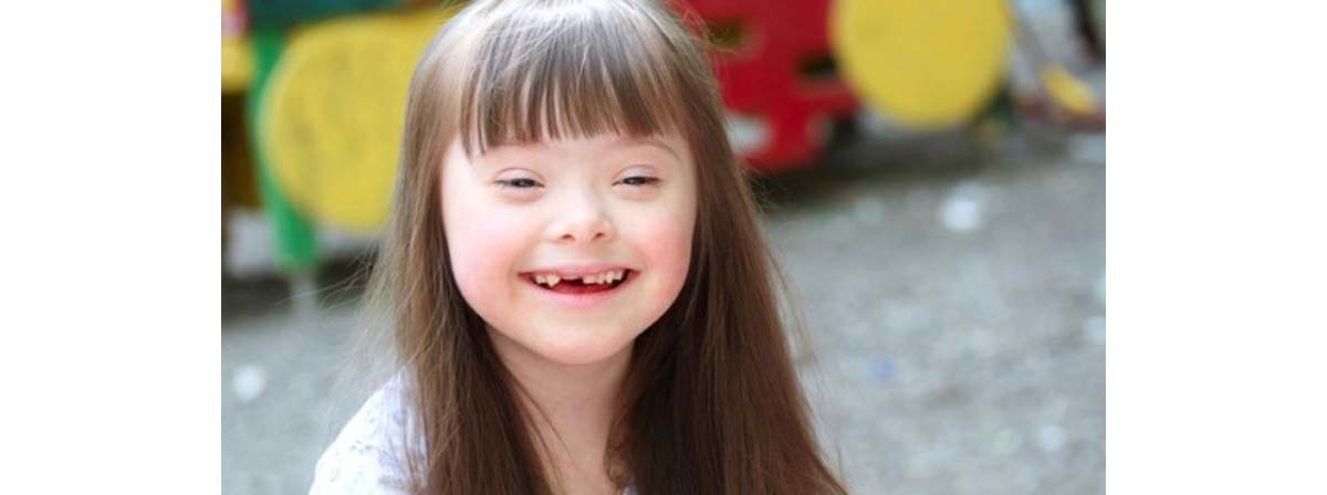 New Findings Give Hope For Down's Syndrome Patients | Mental Health ...