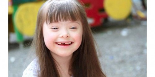 New Findings Give Hope For Down's Syndrome Patients