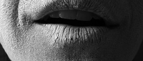 What Causes Dry Skin in Winter and How to Treat It?