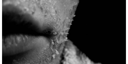 What Causes Dry Mouth, And What To Do About It