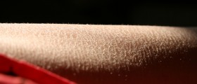 Scaly Skin? What You Need To Know About Ichthyosis