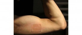 Diet patches