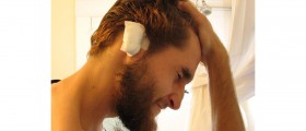 Cosmetic Ear Surgery (Otoplasty): Procedure, Risks, Recovery, and Cost
