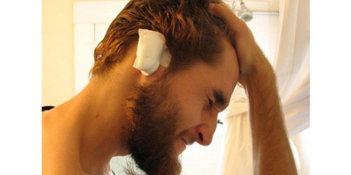 Cosmetic Ear Surgery (Otoplasty): Procedure, Risks, Recovery, and Cost