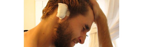 Cosmetic Ear Surgery (Otoplasty): Procedure, Risks, Recovery, and Cost