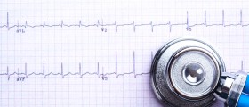 What Is An EKG (Electrocardiogram) And How Does It Help Diagnose Coronary Heart Disease?