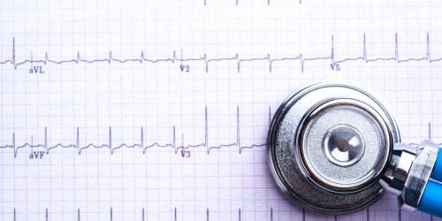 What Is An EKG (Electrocardiogram) And How Does It Help Diagnose Coronary Heart Disease?