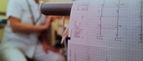 Atrial Fibrillation Treatment