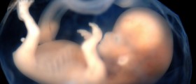 Fetus In Fetu: A Baby Inside Of Another