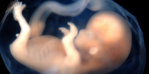 Fetus In Fetu: A Baby Inside Of Another