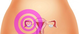 Endometriosis & Hysterectomy
