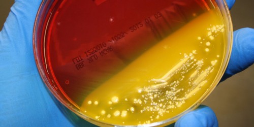 E. Coli - New Treatment Options