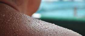 That Stinks! What Can You Do About Excessive Sweating?