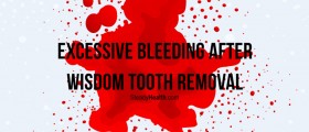 Excessive Bleeding After Wisdom Tooth Removal: What Now?