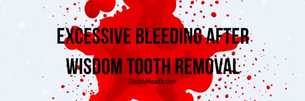 Excessive Bleeding After Wisdom Tooth Removal: What Now?