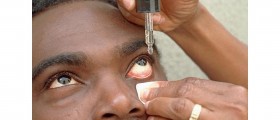 Eye Drops That Lower Cholesterol, Fight Age-Related Blindness