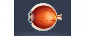 What is Age Related Macular Degeneration?