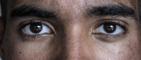 Vitamin C May Help Reduce the Risk of Cataract