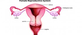 Tubal ligation side effects