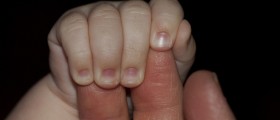 Does The Length Of Your Index Finger Predict Cancer?