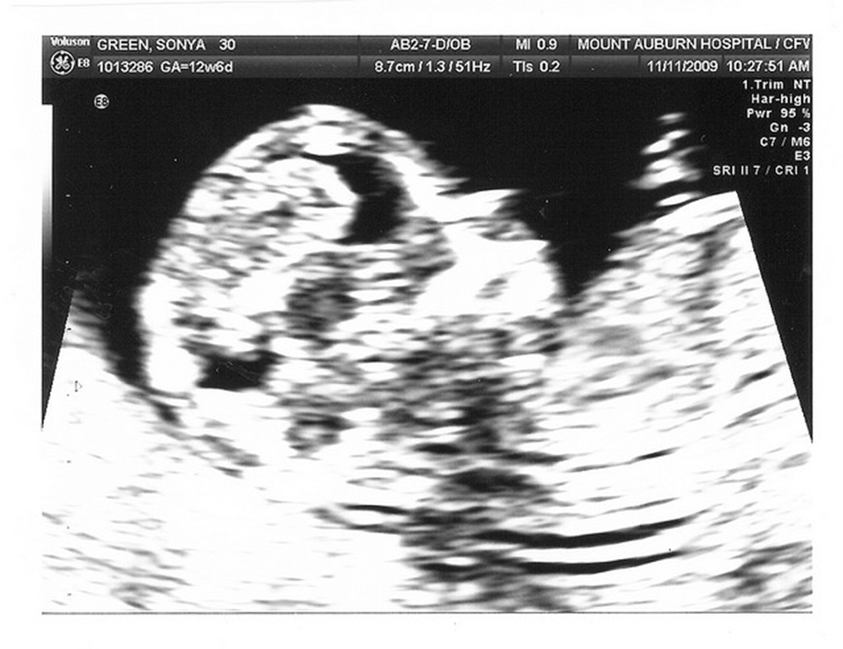 贝贝 儿童 怀孕的女人 男孩 怀孕图片下载 - 觅知网