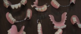 What Are Flexible Dentures? How Are They Better Than Conventional Dentures?