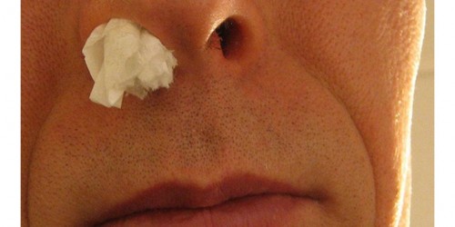 Natural Cold And Flu Remedies