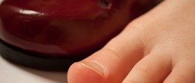 Mortons Neuroma: Symptoms and Treatment of Plantar Neuroma