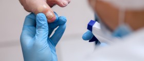 Could You Have A Fungal Nail Infection? What Are The Symptoms, And How Do You Treat Nail Fungus?