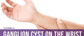 Ganglion Cyst On The Wrist: What Is That Hard Lump That Feels Like a Bone or Tumor?