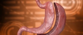 Gastric Bypass Surgery: The Best Slimming method