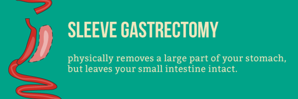 Who Should Consider Bariatric Surgery To Lose Weight?
