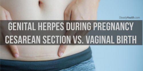 Genital Herpes During Pregnancy: Cesarean Section Vs. Vaginal Birth