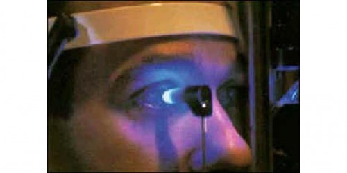 Glaucoma: Tests & Diagnosis