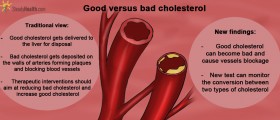 "Good" And "Bad" Cholesterol: Not As Simple As It Sounds