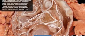 Top 3 Essential Pathology Apps for iPhones and Androids