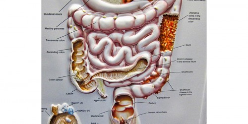 Who should have colonoscopy exam?