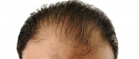 Scientists Discover How To Regenerate Hair And Skin