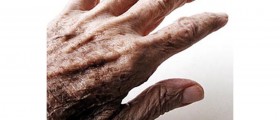 Available medications for Parkinson's Disease!