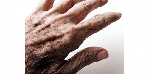 Available medications for Parkinson's Disease!