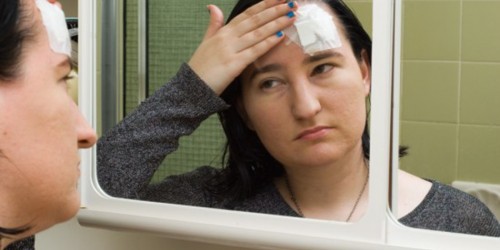 Women Have Harder Time Recovering From Concussions Than Men