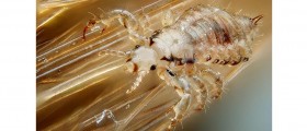Head Lice: The Truth And The Myths