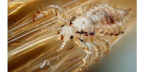Head Lice: The Truth And The Myths