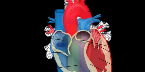 Aortic Arch: Pros and Cons of Aneurysm Surgery