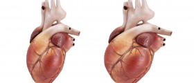 Cardiomyopathy