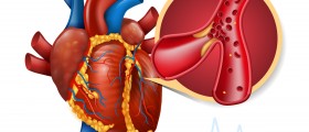 How to prevent the heart attack?